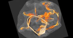 Utrecht Leidsche Rijn CT-scan